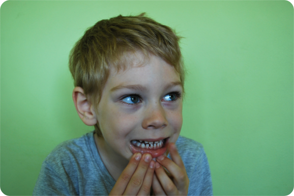 Você está visualizando atualmente Os Dentes de Leite Guardam um Grande Tesouro